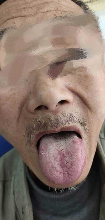 炉中火适合养什么绿植